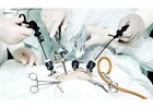 Affordable Minimally Invasive Surgery