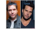 Understanding dane cook plastic surgery — Facts, Speculation, and Expert Insight