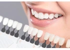 Teeth Alignment Treatment in Panchkula | Dentxperts Clinic