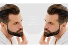 Advanced Beard Hair Transplant