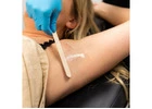 Laser Hair Removal in Fort Collins CO Smooth Lasting Results