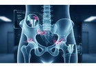Hip Pain Relief Experts | Trusted Orthopedic Care