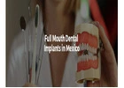 Full Mouth Dental Implants in Mexico with Teeth Savers