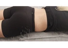 Fast-Acting Dry Needling Therapy Mosman | Strength Clinic