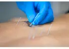 Natural wellness with Chinese medicine san francisco care