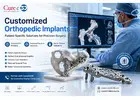 Customized Orthopedic Implants in India for Complex Surgical Cases