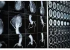 Cardiac MRI Donnybrook