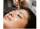 Professional Microneedling in Highbury London
