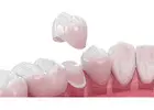 Professional Teeth Cleaning Services in San Antonio