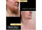 Bay Area Plastic Surgery