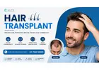 Thinking About a Hair Transplant? Know the Facts Before You Decide