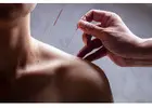 Acupuncture NYC | Sports Medicine & Dry Needling | Pain Management | Grand Madison - Bryant Park Mid