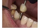 Trusted Dental Clinic in Tijuana – Comprehensive Care for a Brighter, Healthier Smile