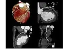 Cardiac CT Wallan