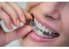 Transform Your Smile with an In****lign Diamond Plus Provider in Richmond, VA