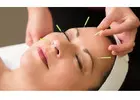 Natural Facial Acupuncture for Skin Care
