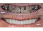 General Dentistry Lexington KY