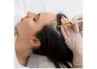 CO2 Laser Treatments Fort Collins | Skin Resurfacing