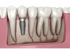 Finding the Right Dentist Near Me in Abbotsford