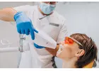 LED Teeth Whitening Singapore for a Brighter Smile