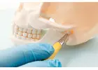 Mitcham Dentist for Reliable and Professional Dental Services