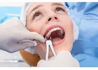 Tooth Extraction Healing Stages | Abbotsford Dentist