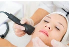 Laser Facial Treatment Daytona Beach