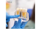 Dental Implant Manufacturers Honduras for Custom Supply