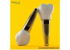 Clinics Trust These Dental Implant Suppliers in Venezuela
