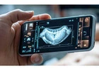On Demand Mass Ultrasound Imaging Services by Medex Diagnostic