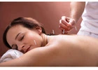 Acupuncture Thornhill: Awakens Inner Healing Energy at Midori Day Spa