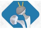 Top-Quality Hip Replacement Prosthesis Implants Engineered for Precision & Longevity