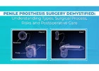Penile Prosthesis Surgery In Bangalore  | Worldofurology