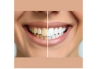Best Dental Implants in Kolkata