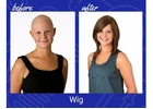 Hair Solutions for Hair Loss After Chemo Treatment