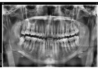 Biological Dentist in Tijuana, Mexico – Safe, Natural Dental Care