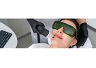 Laser treatment for face pigmentation