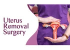 Uterus Removal Surgery In Bangalore | Worldofurology