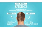 Restore Your Hair and Confidence with New Touch Hair Transplant Clinic Ahmedabad