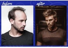 Transform Your Style with Proven Hair Loss Solutions