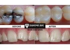 Diamond Bar dental group Diamond Bar, CA