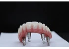 Dental implants Tijuana offers natural-looking and durable teeth replacements