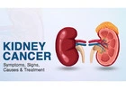 Kidney Cancer Treatments In Bangalore | Worldofurology