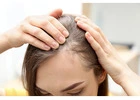 Find the Best Hair Loss Treatment Clinic in Noida