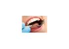 Dental Implants in McKinney, TX