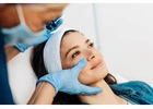 PRP Facial Treatment in Mumbai At Adore Skin Clinic