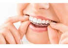 In****lign Teeth Braces in Panchkula | Dentxperts Clinic